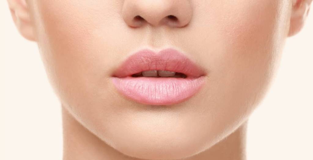 Preenchimento labial em BH 3 depois