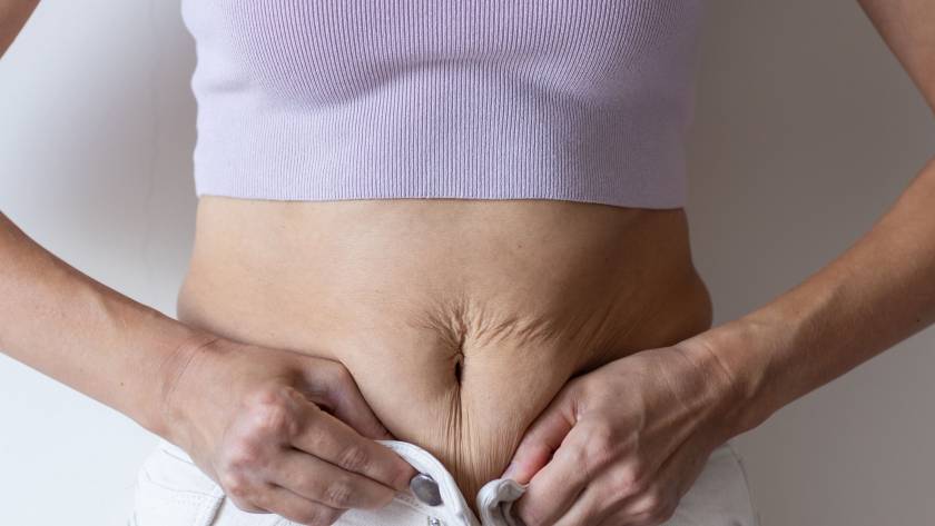 flacidez na barriga