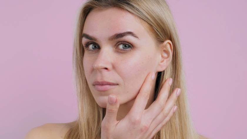 acne_hormonal