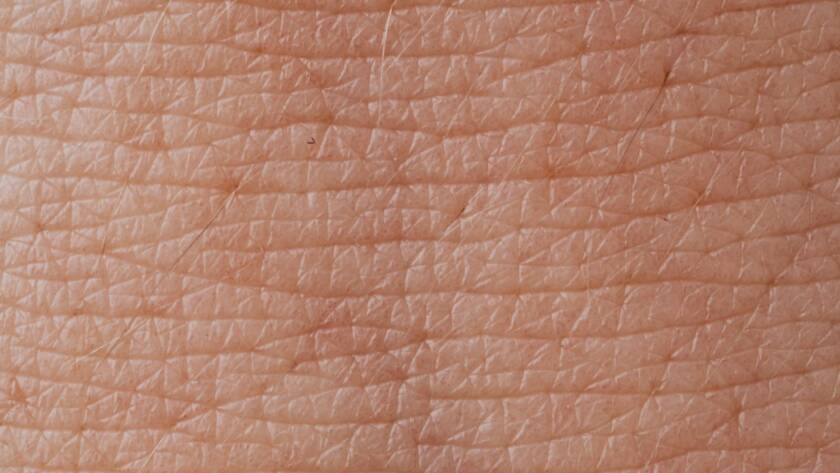 Textura da pele em close-up representando cuidado com psoríase na dermatologia integrativa em BH