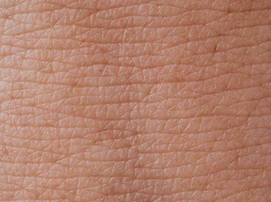 Textura da pele em close-up representando cuidado com psoríase na dermatologia integrativa em BH