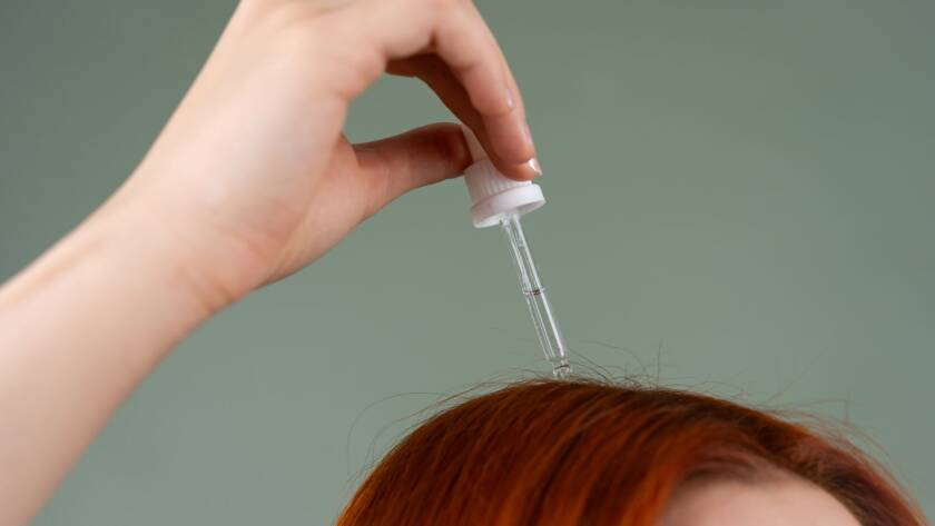 Aplicação de sérum capilar para tratar queda de cabelo na dermatologia integrativa em BH