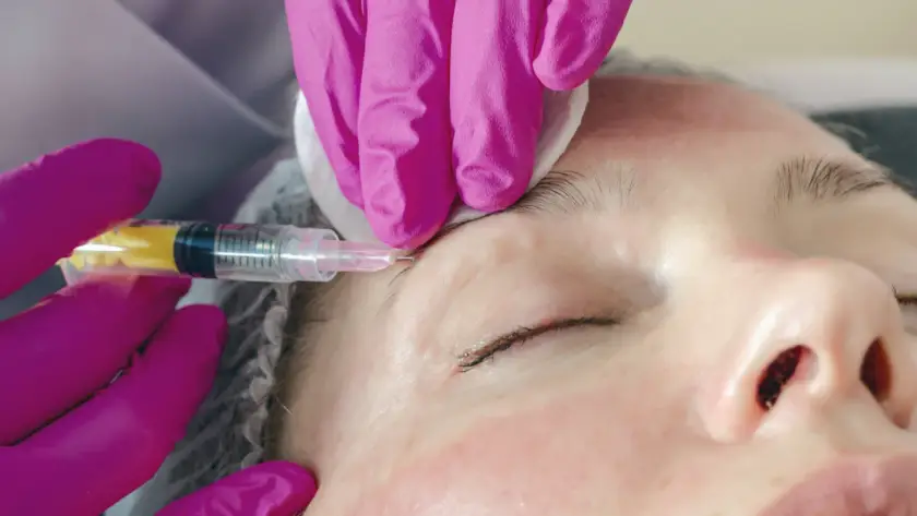 Aplicação de toxina botulínica (botox) na testa de uma mulher por médica em BH