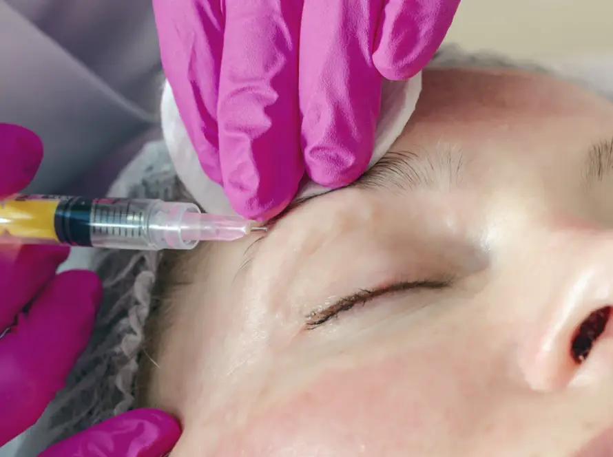 Aplicação de toxina botulínica (botox) na testa de uma mulher por médica em BH