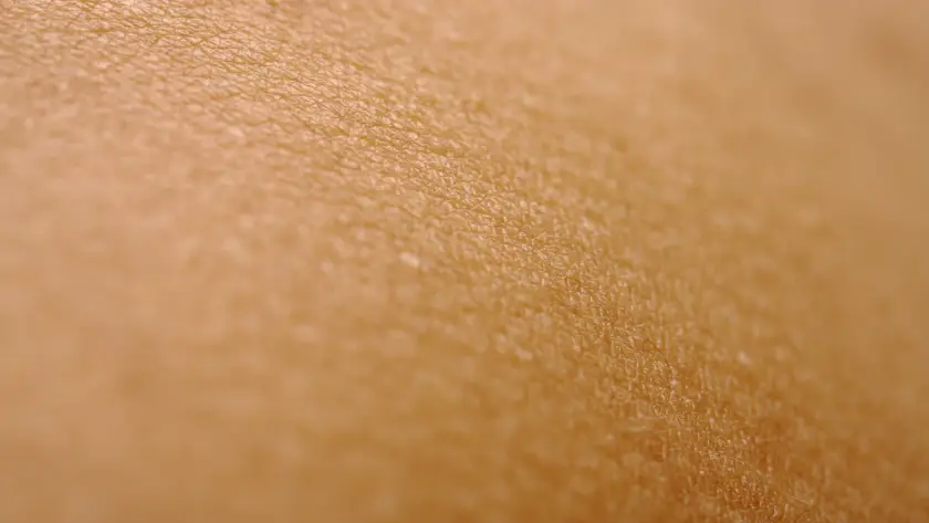 Close da pele com pintas, avaliação em mapeamento de pintas com dermatoscopia