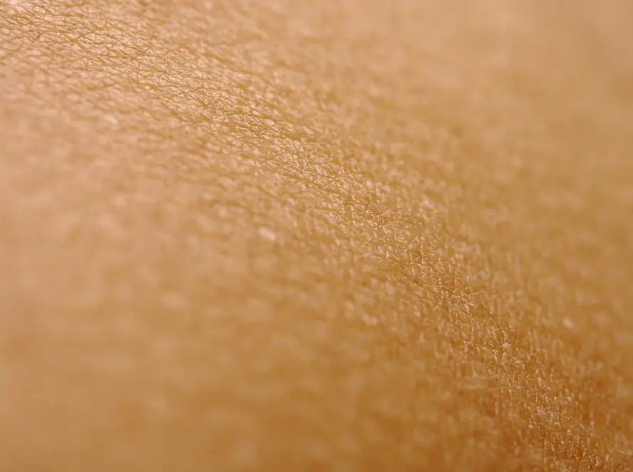 Close da pele com pintas, avaliação em mapeamento de pintas com dermatoscopia