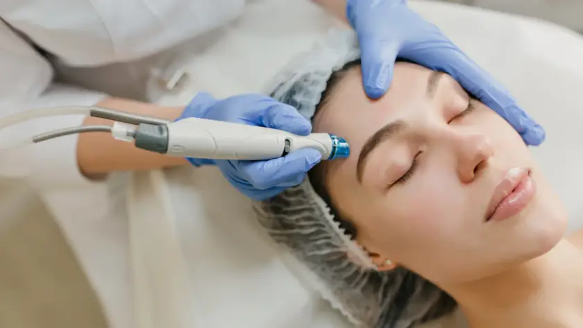 Paciente recebendo sessão de microagulhamento facial em clínica dermatológica