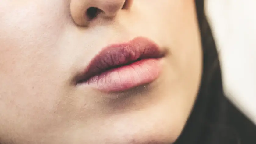 Lábios femininos em close, cuidados antes e depois do preenchimento labial