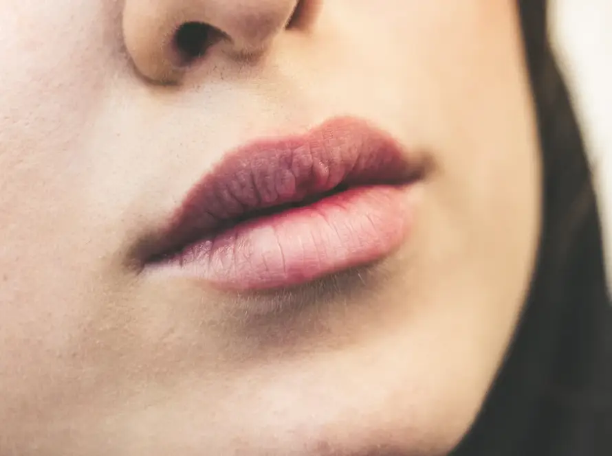 Lábios femininos em close, cuidados antes e depois do preenchimento labial